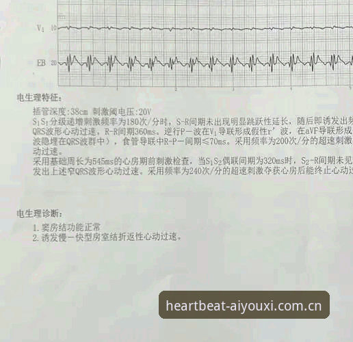 玩出心跳的主张篮球数据 埃里克森5年2次倒下:心脏除颤器与赛场心跳的极限体验报告